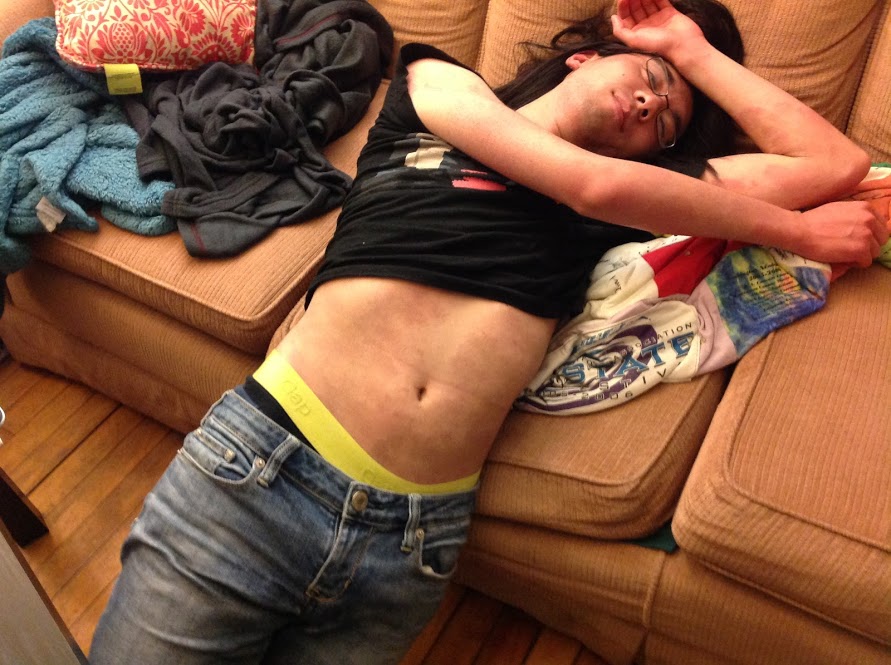 Marina lying on a couch. Her tummy is exposed, showing the brown splotches of eczema scars.